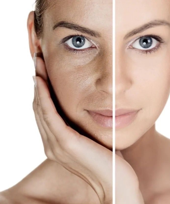 anti wrinkle.jpg